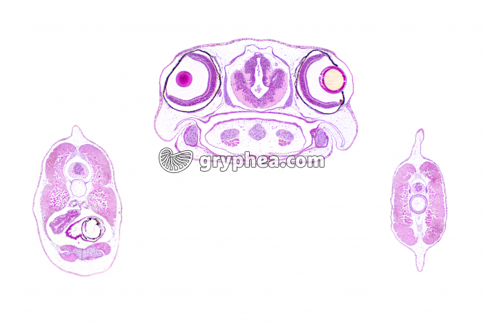 Embryon de grenouille (Tétard) coupe à 3 niveaux différents CT x1,5 - gryphea.org